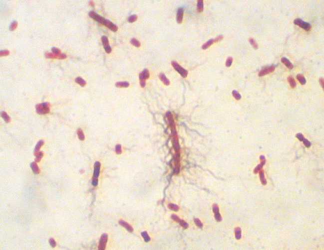 'Bacterias y hongos'
