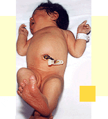 'Anatomía del recién nacido'