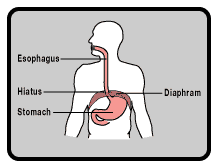 Enfermedades del sistema digestivo
