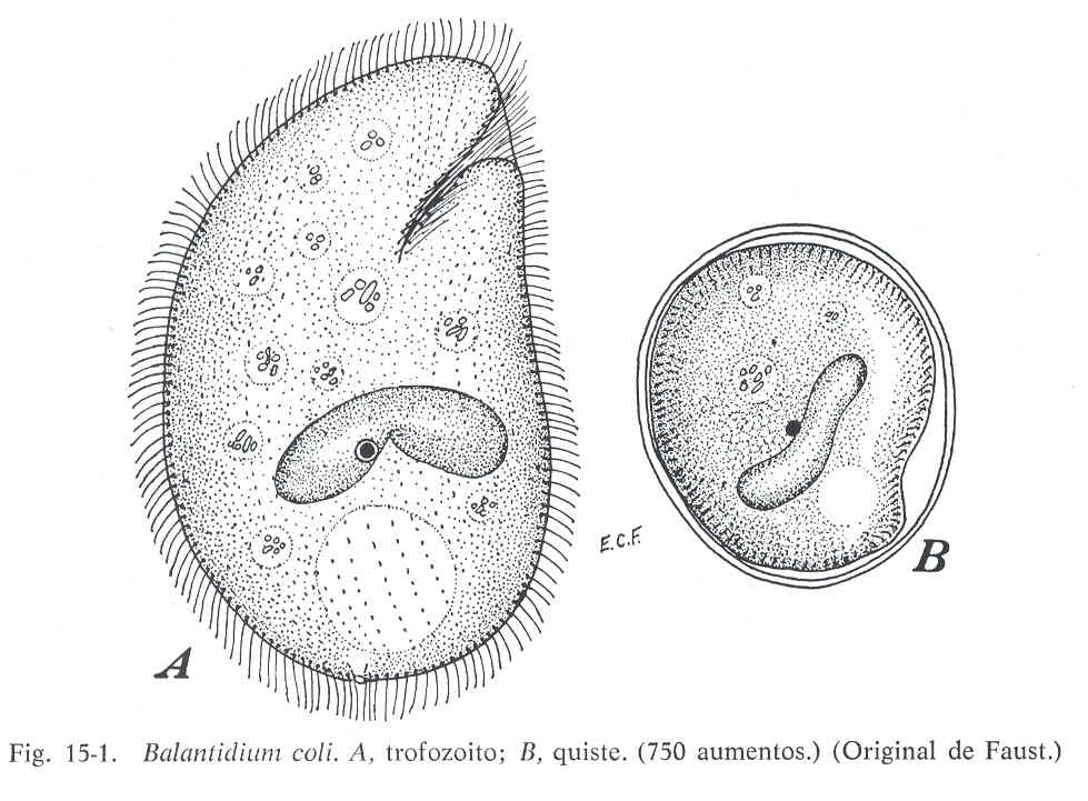Инфузория заболевание. Балантидий кишечный. Циста балантидия. Вегетативная форма Balantidium coli. Balantidium coli схема строения.